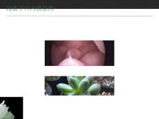 子宫内膜息肉ppt