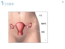 子宫脱垂病人的护理