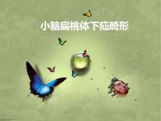 小脑扁桃体下疝畸形