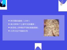 淋巴管肌瘤病的肺部CT表现
