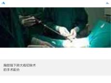 胸腔镜肺大疱切除