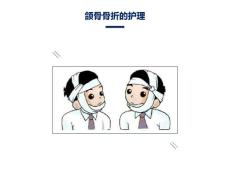 颌骨骨折的护理
