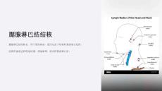 《腮腺淋巴结结核》课件