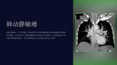 《肺动静脉瘘》课件