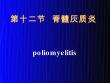 脊髓灰质炎【37页】