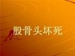 股骨头坏死【67页】