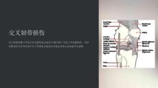 《交叉韧带损伤》课件