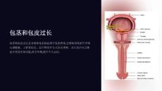 《包茎、包皮过长》课件