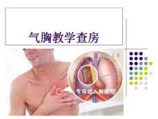 气胸教学查房
