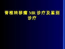 脊柱转移瘤的诊断和鉴别诊断