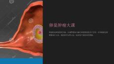 《卵巢肿瘤大课）》课件