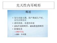 先天性内耳畸形