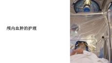 《颅内血肿的护理》课件
