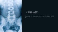《脊柱结核》课件