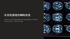 《多系统萎缩MRI》课件