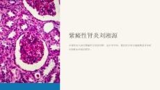 《紫癜性肾炎刘湘源》课件