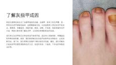 《了解灰指甲成因》课件