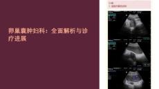 《卵巢囊肿妇科》课件