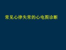 常见心律失常