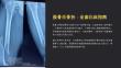 《股骨颈骨折》课件