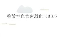 弥散性血管内凝血（DIC）2025
