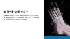 《跖骨骨折诊断与治疗》课件