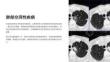 《肺部空洞性疾病》課件