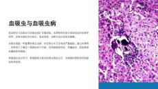 《血吸虫与血吸虫病》课件