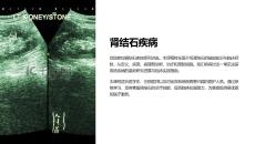 《肾结石疾病》课件