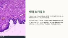 《慢性前列腺炎》课件