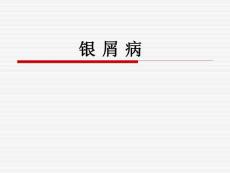 银屑病教学课件