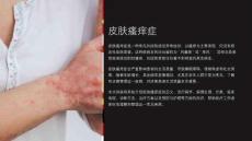 《皮肤瘙痒症》课件