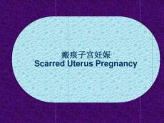 疤痕妊娠课件