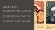 垂体瘤教学课件