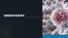 結腸癌教學查房課件