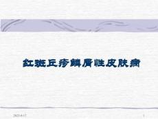 銀屑病-ppt課件