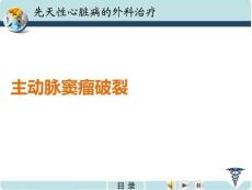 主动脉窦瘤破裂PPT课件
