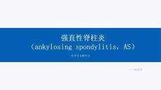 强直性脊柱炎