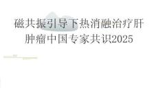磁共振引導(dǎo)下熱消融治療肝腫瘤中國專家共識2025