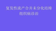 复发性流产合并未分化结缔组织病诊治2026