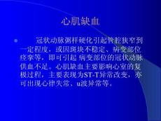 心肌缺血 心肌梗塞