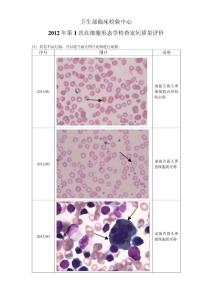 2012年第1次血细胞形态学检查室间质量评价