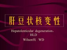 肝豆状核变性　