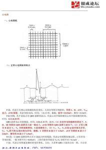 史上最詳細(xì)的心電圖教程