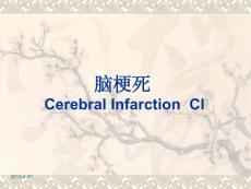 脑梗塞课件