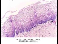 病理解剖学图像库11-女性生殖系统疾病