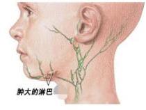 小梨子